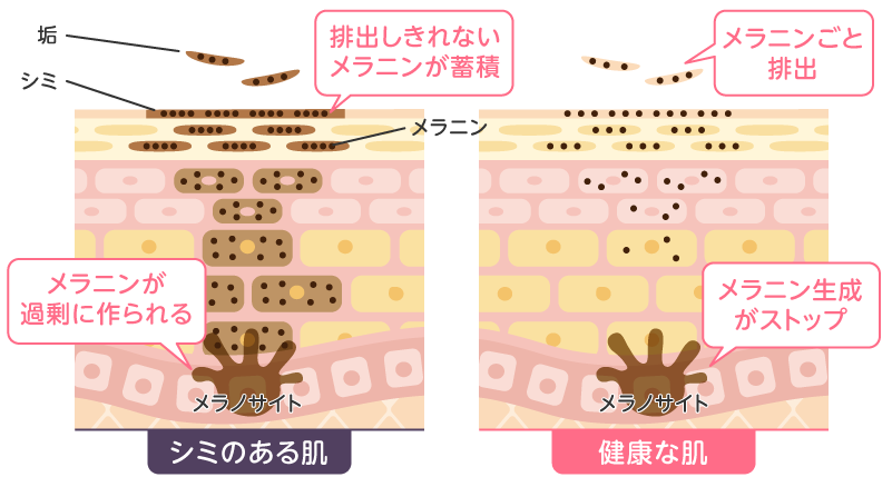 蓄積されるメラニン