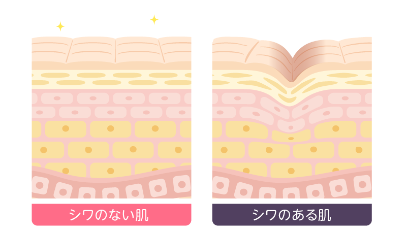 シワ断面図